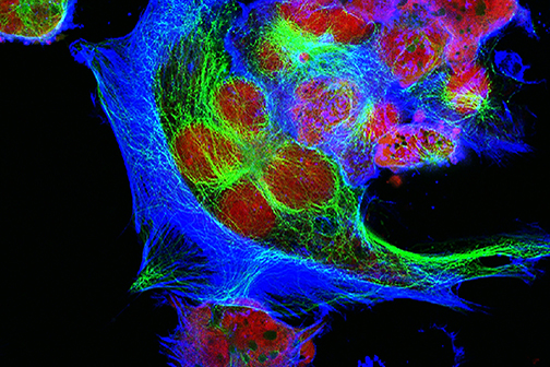 human neuroblastoma cells